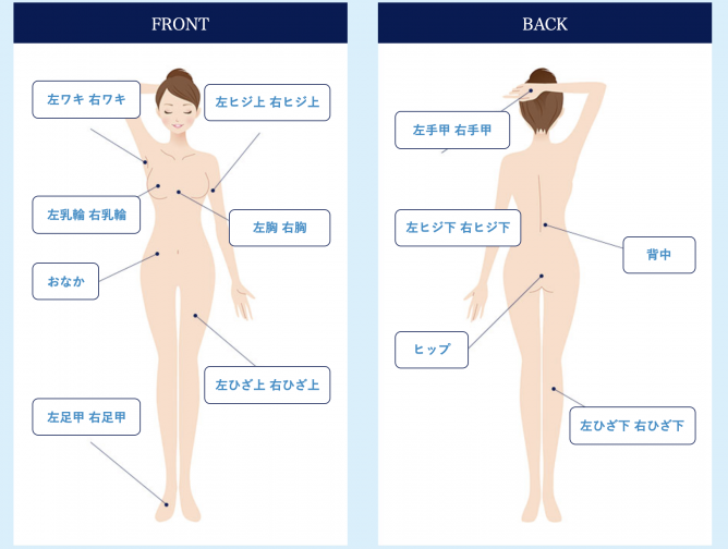 フレイアクリニック全身脱毛範囲