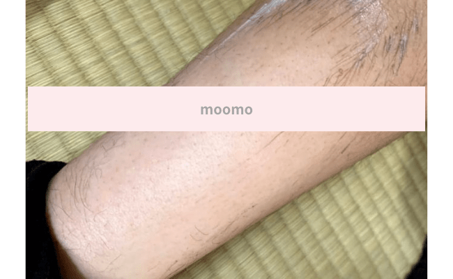 moomo7