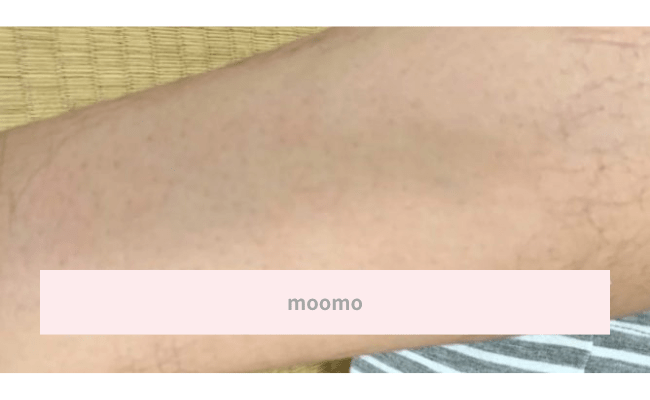 moomo8