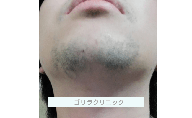 golir12