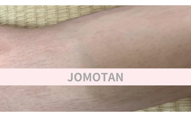 JOMOTAN