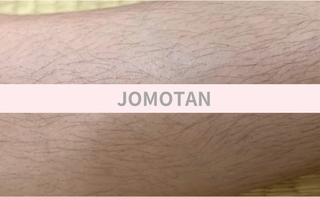 JOMOTAN