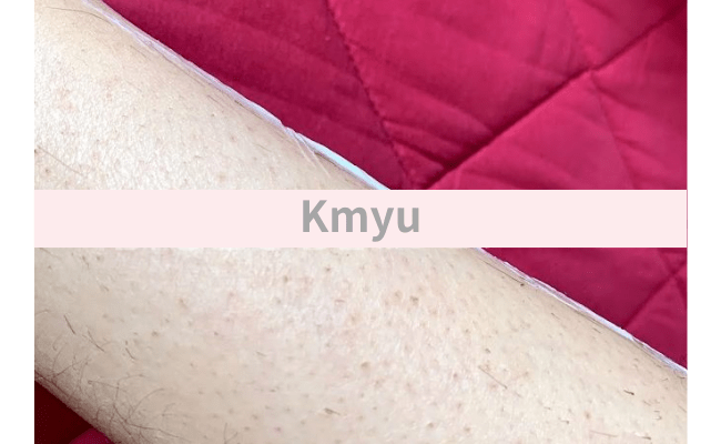 kmyu7