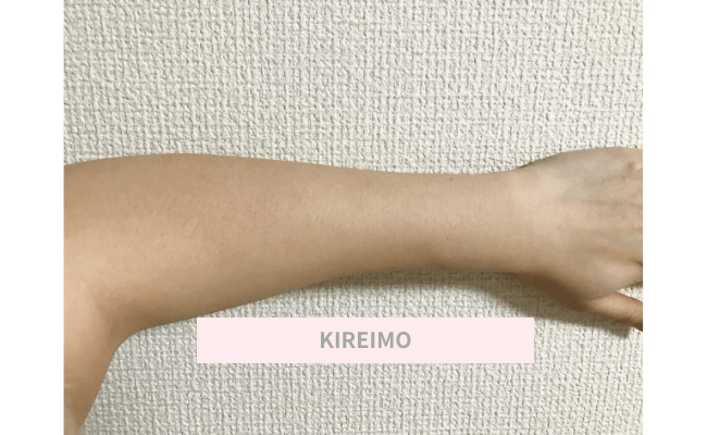 KIREIMO14