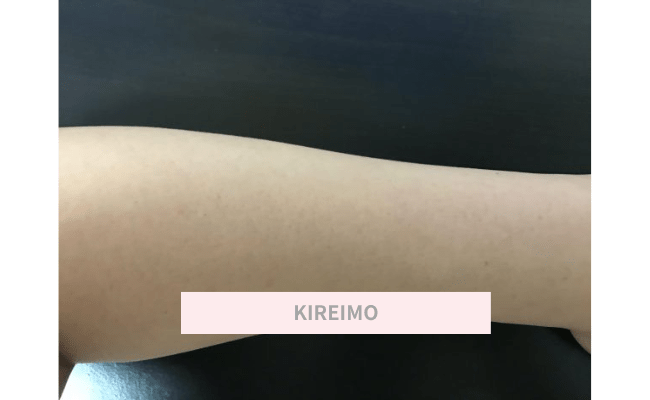 KIREIMO16
