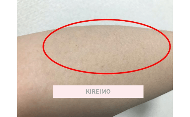 KIREIMO17