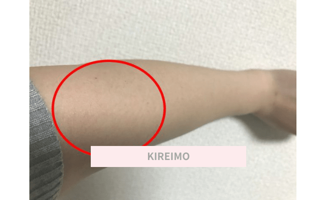 KIREIMO19