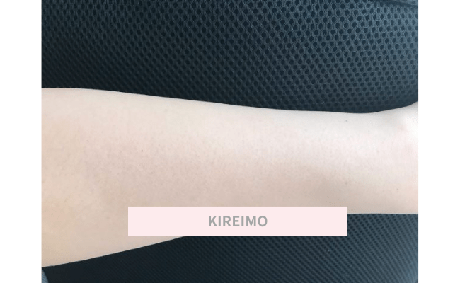 KIREIMO20