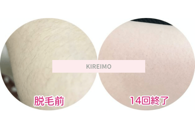 KIREIMO21