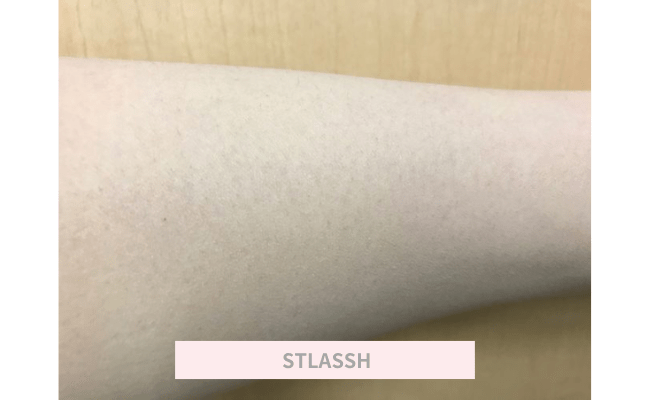 STLASSH17